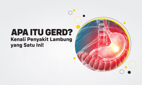 Apa Itu GERD? Penyakit, Gejala, Penyebab, Dan Obat GERD